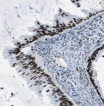 OSBPL2 Rabbit Polyclonal Antibody