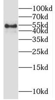 OSBPL2 Rabbit Polyclonal Antibody