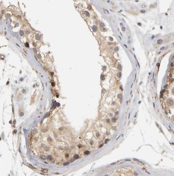 OSBPL9 Rabbit Polyclonal Antibody