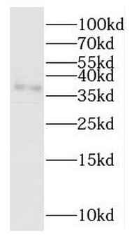 OGN Rabbit Polyclonal Antibody