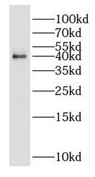 OSTM1 Rabbit Polyclonal Antibody
