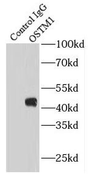 OSTM1 Rabbit Polyclonal Antibody