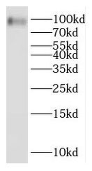 OTOP3 Rabbit Polyclonal Antibody