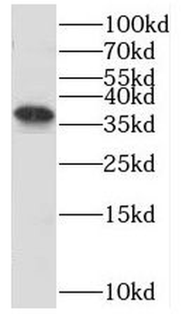 OTUD6B Rabbit Polyclonal Antibody