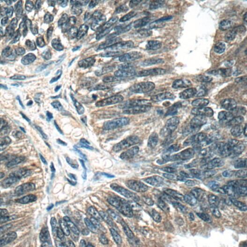 OTUD6B Rabbit Polyclonal Antibody
