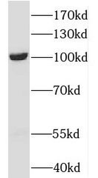 OTUD7B Rabbit Polyclonal Antibody