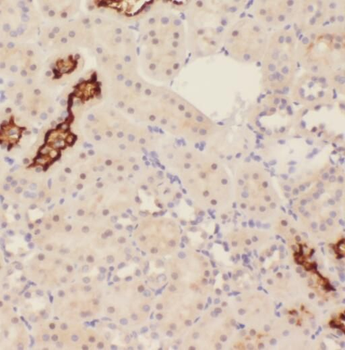 OTUD7B Rabbit Polyclonal Antibody