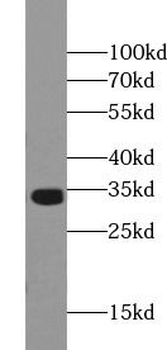 OTX2 Rabbit Polyclonal Antibody