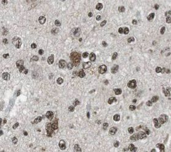 OTX2 Rabbit Polyclonal Antibody
