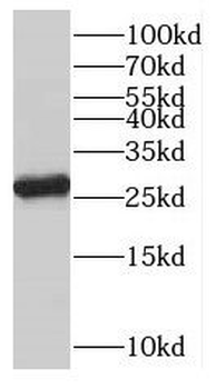OVCA2 Rabbit Polyclonal Antibody