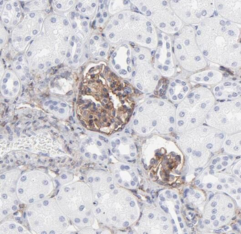OVCA2 Rabbit Polyclonal Antibody