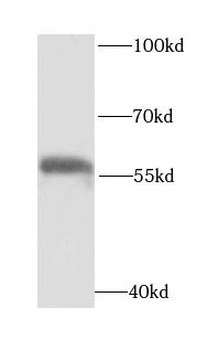 OXCT1 Rabbit Polyclonal Antibody