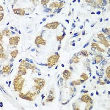 OXCT1 Rabbit Polyclonal Antibody