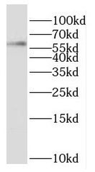 OXSR1 Rabbit Polyclonal Antibody