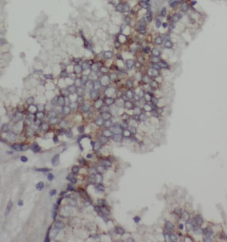 OXSR1 Rabbit Polyclonal Antibody