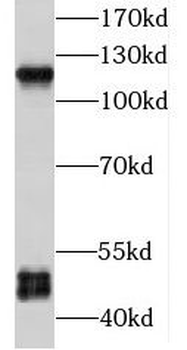 P2RX5 Rabbit Polyclonal Antibody