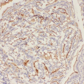 P2RY13 Rabbit Polyclonal Antibody
