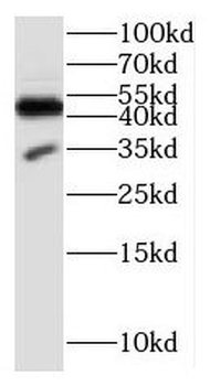 CDK5R1 Rabbit Polyclonal Antibody