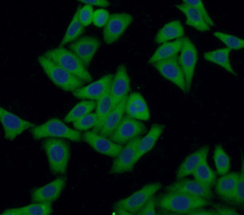 TP53 Rabbit Polyclonal Antibody