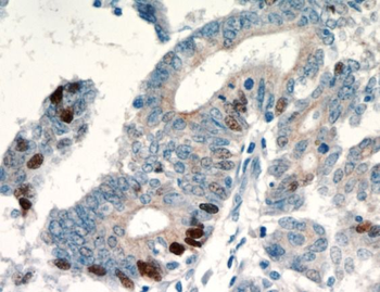 TP53 Rabbit Polyclonal Antibody