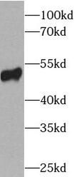 TP53 Mouse Monoclonal Antibody