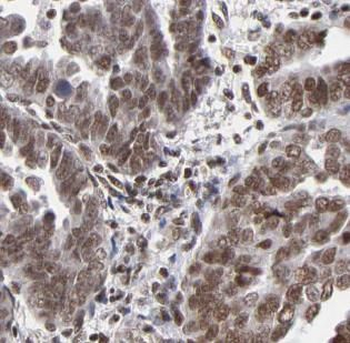 TP53 Mouse Monoclonal Antibody