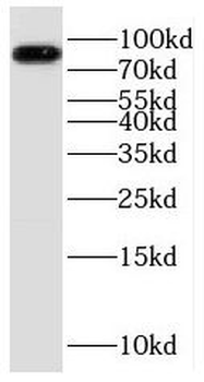 ALDH18A1 Rabbit Polyclonal Antibody