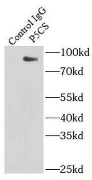 ALDH18A1 Rabbit Polyclonal Antibody