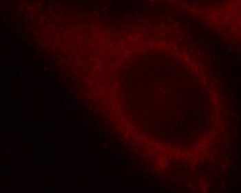 RELA Rabbit Polyclonal Antibody