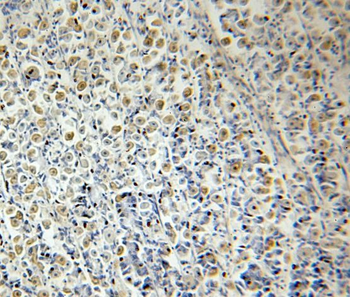 RELA Rabbit Polyclonal Antibody
