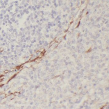 PAFAH1B3 Antibody
