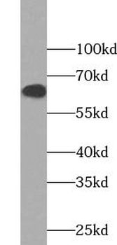 PAK1 Rabbit Polyclonal Antibody