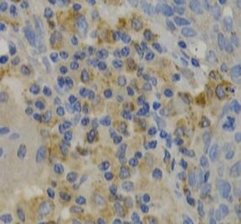 PAK1 Rabbit Polyclonal Antibody