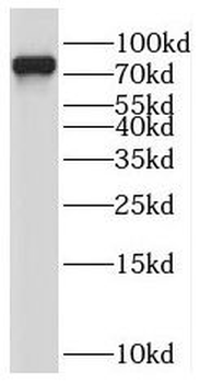 PALMD Rabbit Polyclonal Antibody