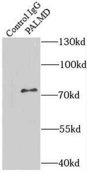 PALMD Rabbit Polyclonal Antibody