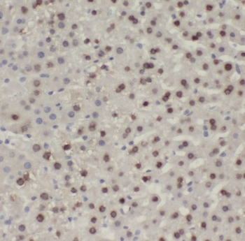 PALMD Rabbit Polyclonal Antibody