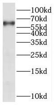 PANK1 Rabbit Polyclonal Antibody