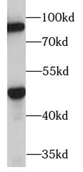 TENT4B Rabbit Polyclonal Antibody