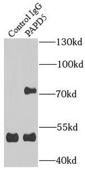 TENT4B Rabbit Polyclonal Antibody
