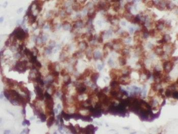 PARD6B Rabbit Polyclonal Antibody