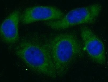 PARP10 Rabbit Polyclonal Antibody