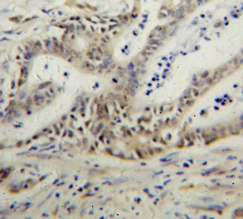 PARP3 Rabbit Polyclonal Antibody