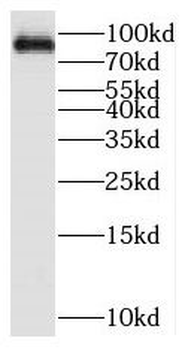 PARP9 Rabbit Polyclonal Antibody