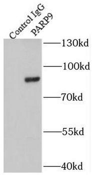 PARP9 Rabbit Polyclonal Antibody