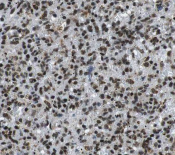 PARP9 Rabbit Polyclonal Antibody