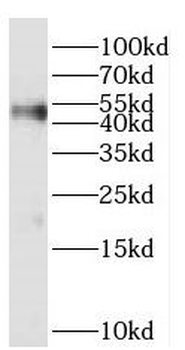 PARVA Rabbit Polyclonal Antibody