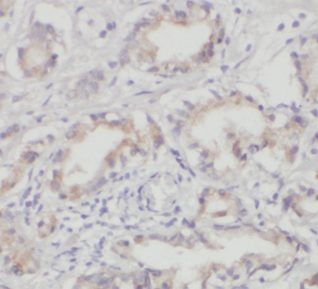 PARVA Rabbit Polyclonal Antibody