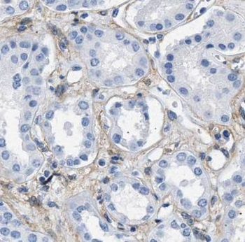 PARVA Rabbit Polyclonal Antibody