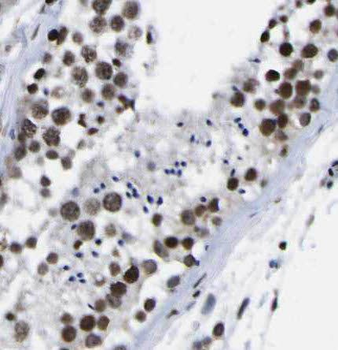 PASK Rabbit Polyclonal Antibody