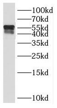 PAX8 Rabbit Polyclonal Antibody